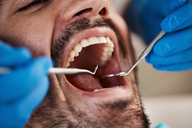 Best Urgent Tooth Repair  in Menlo Park Terrace, NJ